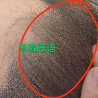 米萊養發